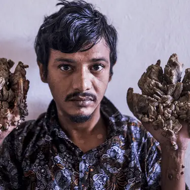 MUNIR UZ ZAMAN / Contributor via Getty