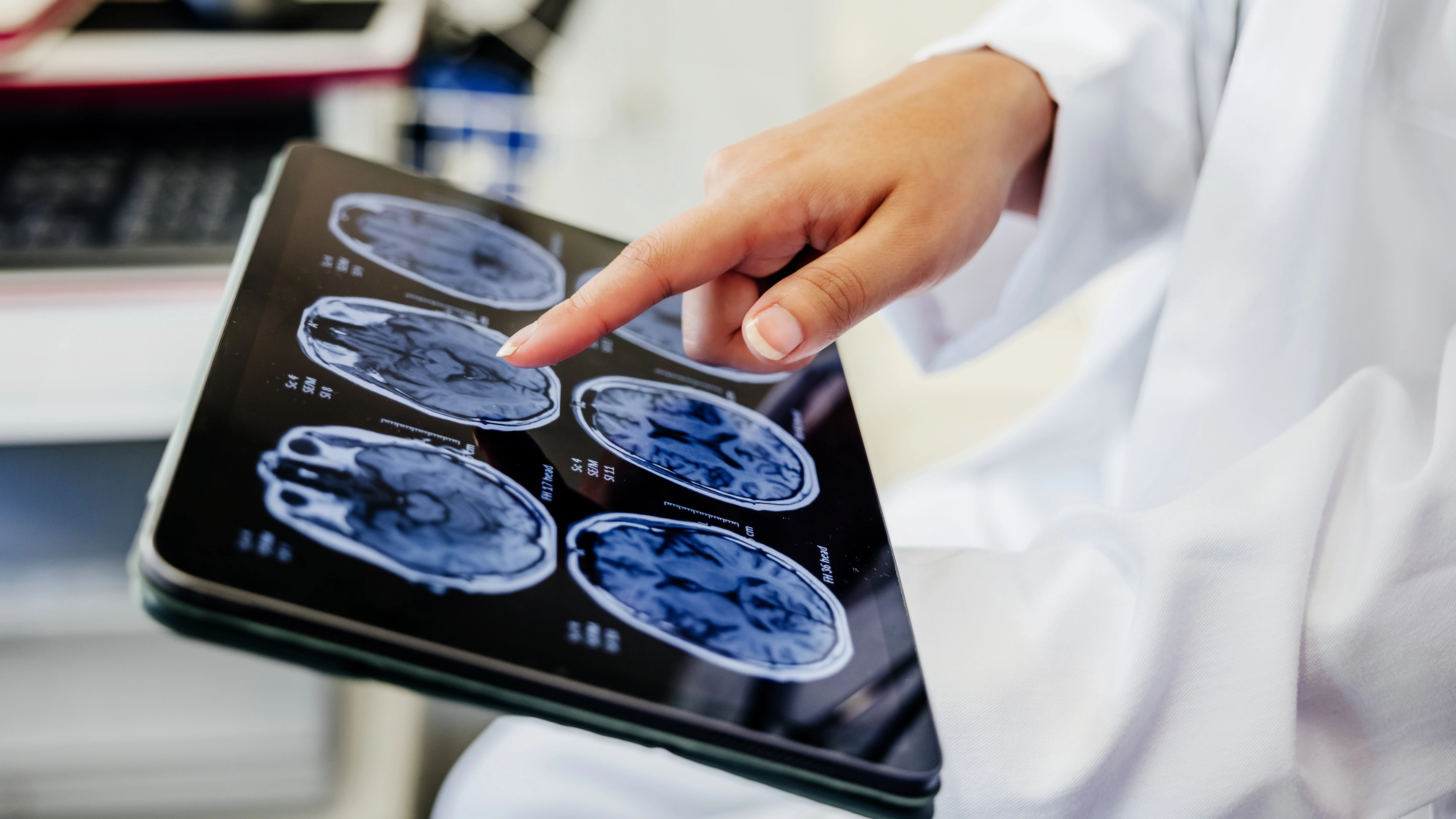 Nutritionist shares 5 foods that significantly boost your brain health
