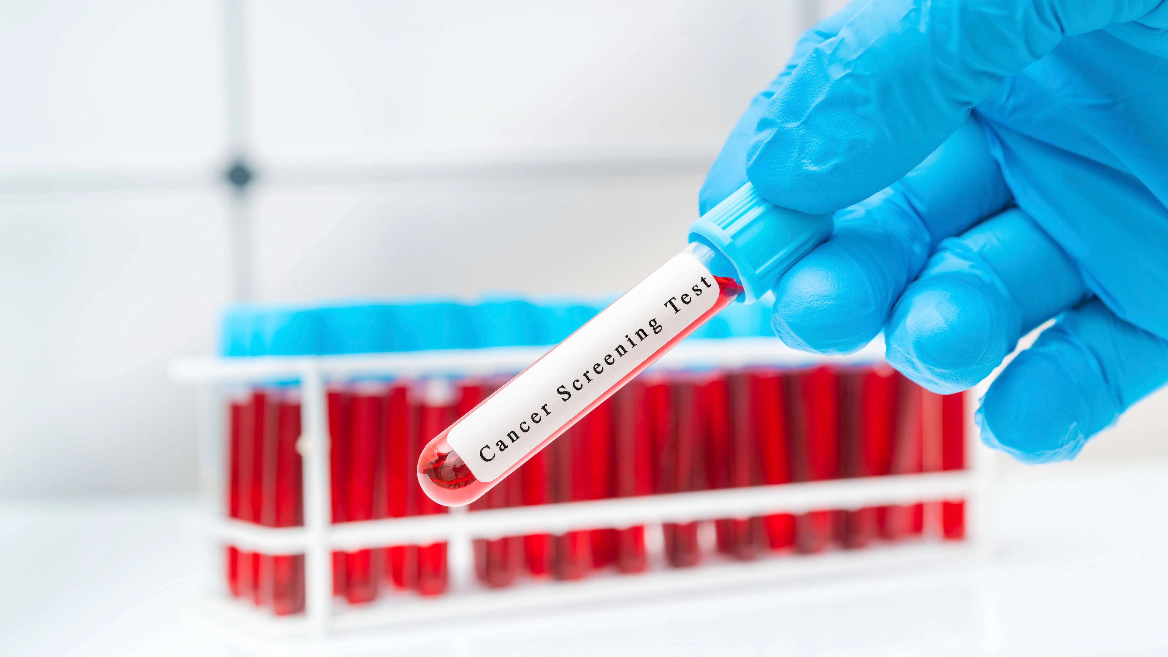 Cancer is now diagnosed every 80 seconds as one type hits record high in young people