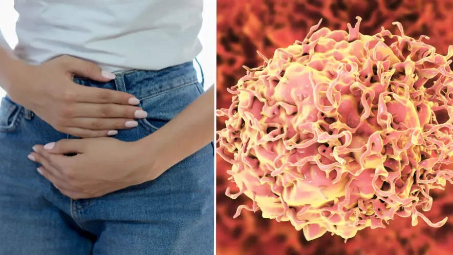 Surgeon reveals five foods linked to rise in ‘silent killer’ after surge amongst Gen Z and Millennials