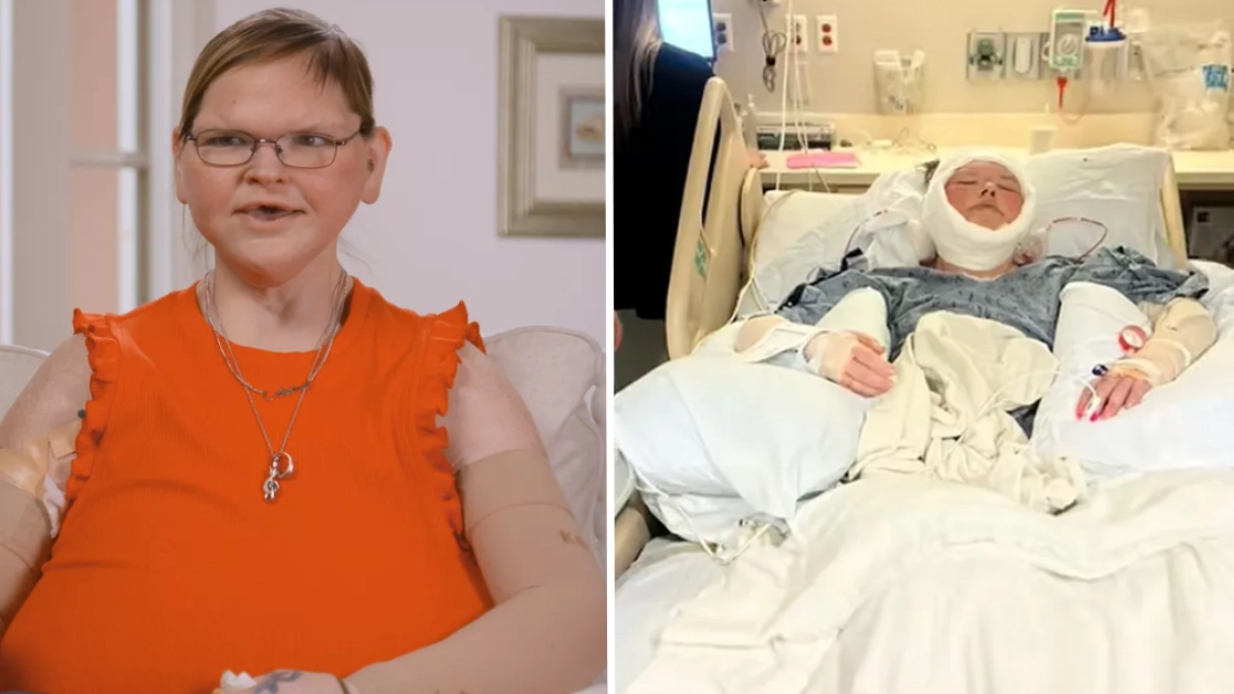 1000-lb Sisters star Tammy Slaton revealed 'biggest concern' after skin removal surgery as she shows off shocking transformation
