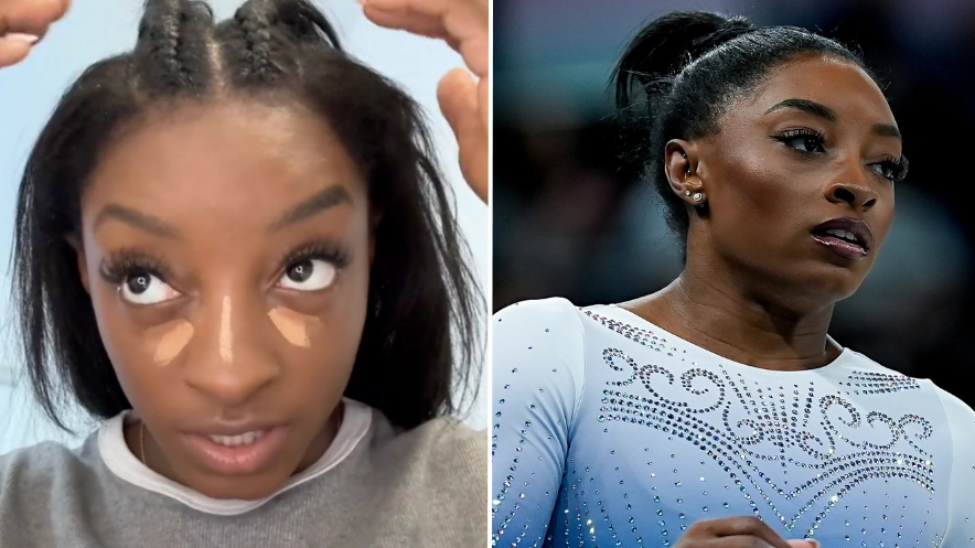 Simone Biles opens up on one cosmetic procedure that put her off for life