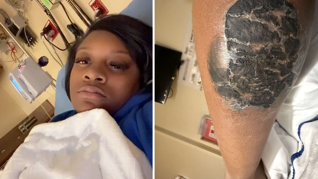 Woman hospitalised after tattoo artist made dangerous mistake while tattooing her dead brother’s face onto her