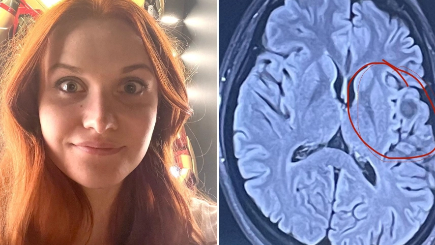 Taylor Swift fan diagnosed with rare condition after she started to forget her favourite song lyrics