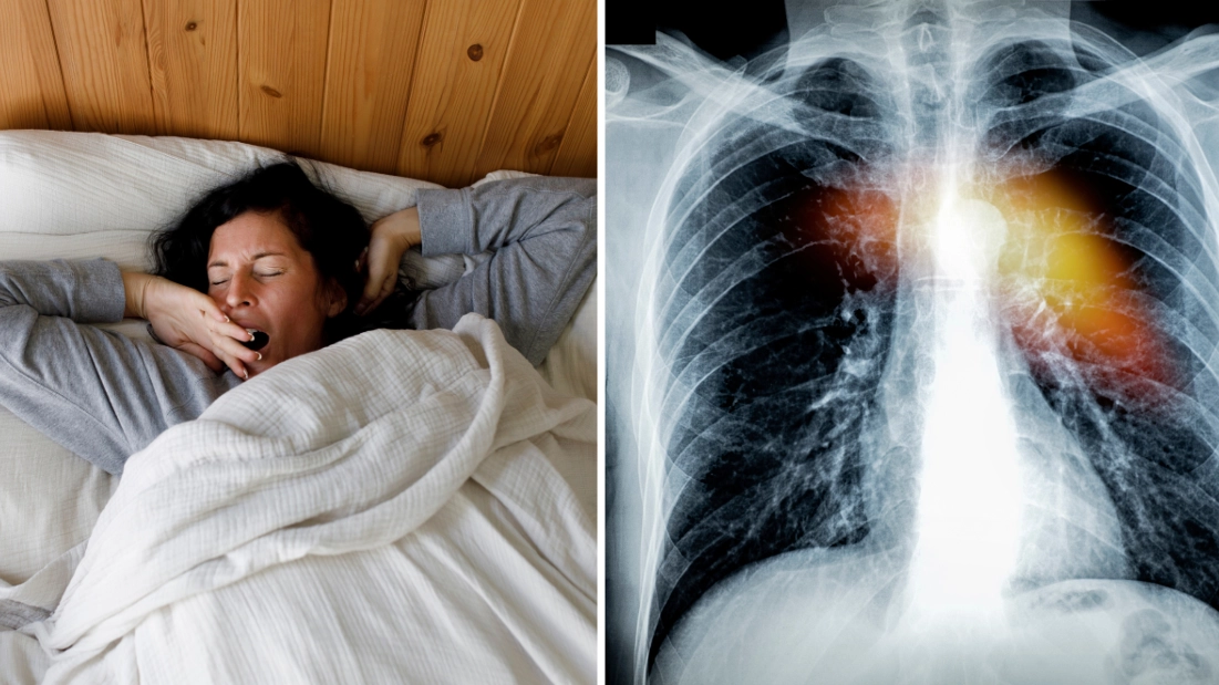 Doctor warns anyone who sleeps in specific position could have ‘hidden’ deadly health condition