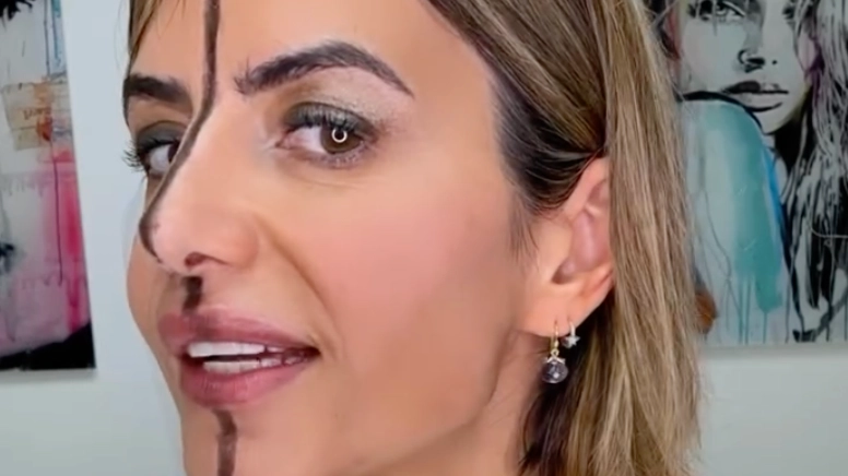Doctor injects Botox into one side of her face and reveals shocking effects