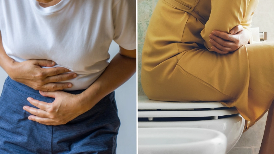 Doctor shares 6 common signs of colon cancer in young people
