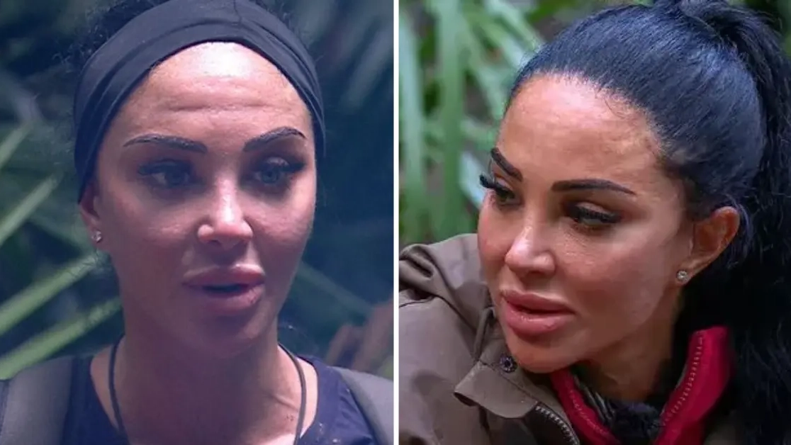 Heartbreaking truth behind I’m A Celeb star Tulisa’s facial procedures as she's voted off show