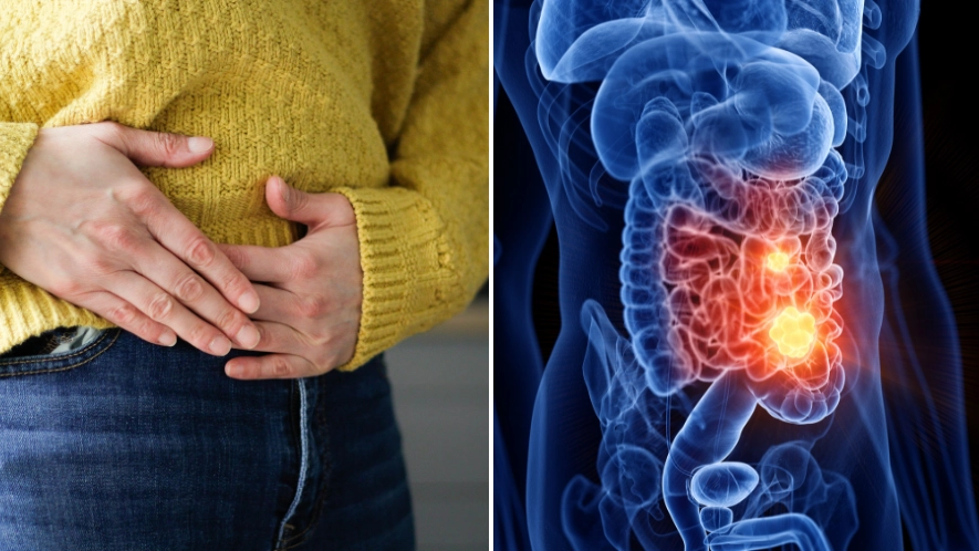 Scientists reveal risk of 'silent killer' cancer could be significantly slashed by drinking one thing every day