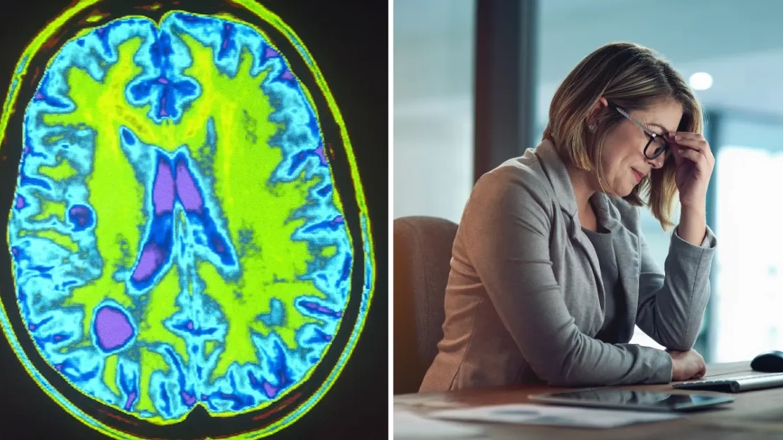 ‘Invisible’ MS symptoms to look out for that people don’t realise is ‘unseen side’ of disease