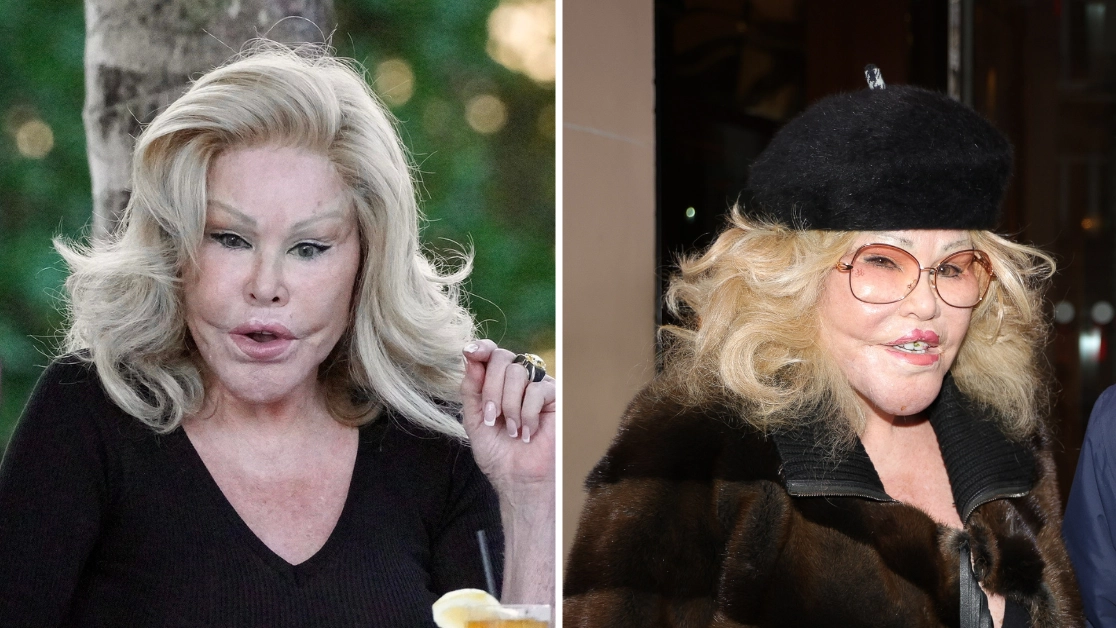 ‘Catwoman’ Jocelyn Wildenstein dies following nap with her partner