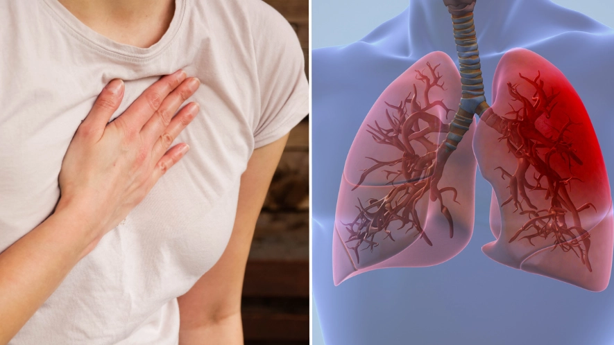 There's a reason you might be getting sudden sharp pains in your chest