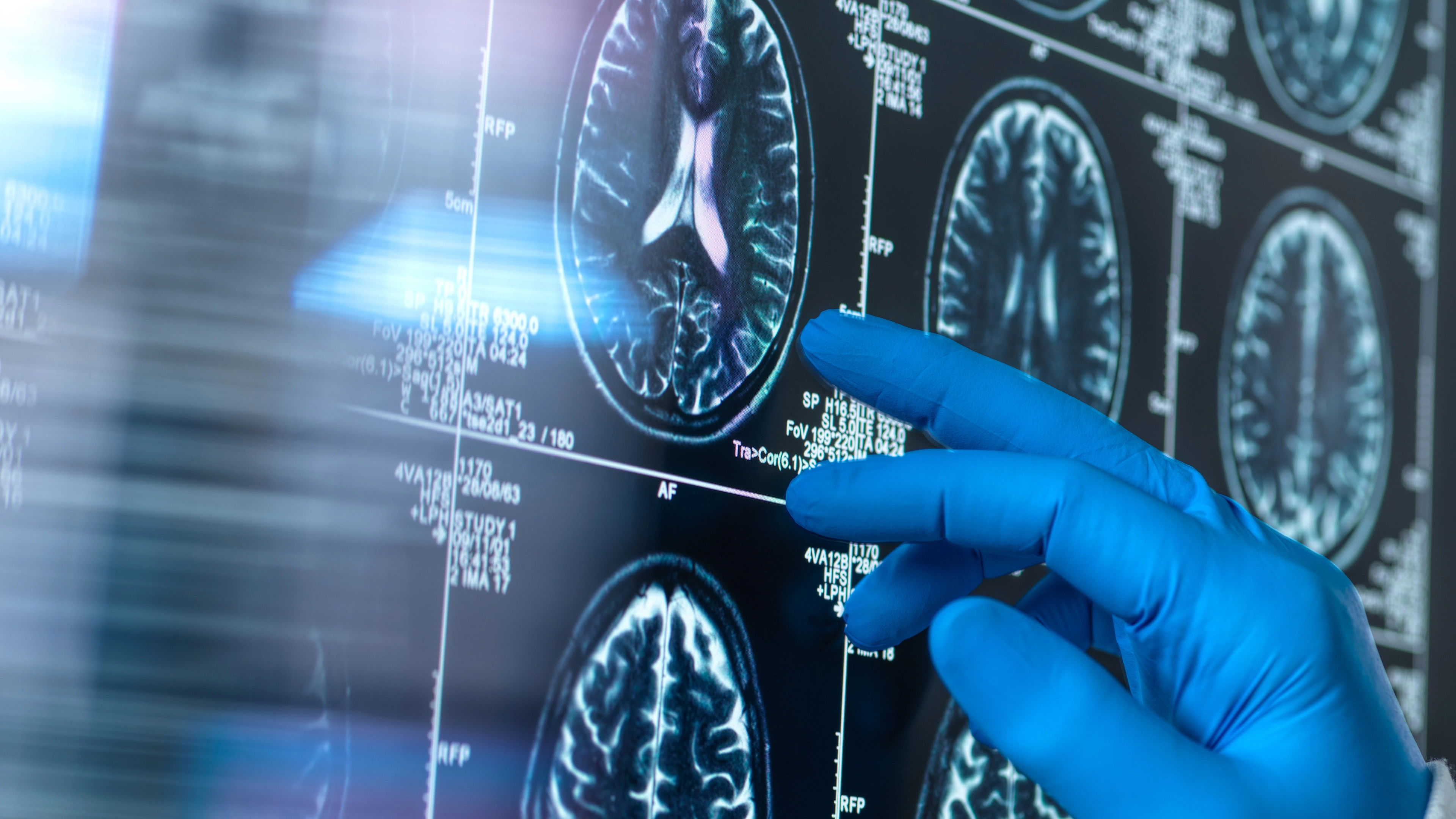 Professor reveals eight money mistakes that could be an early sign of dementia