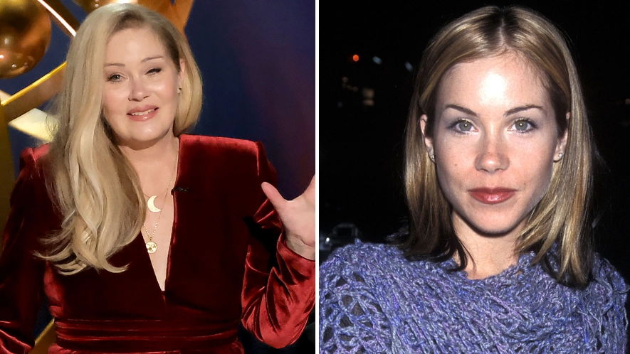 Christina Applegate reveals shocking reason behind her only plastic surgery procedure