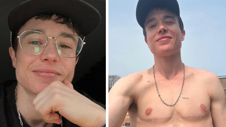 Elliot Page praised by fans for sharing shirtless snap revealing surgery scars