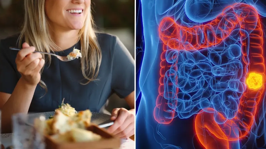 Doctors blame one common food habit for huge surge of colon cancer cases in Gen Z and Millennials