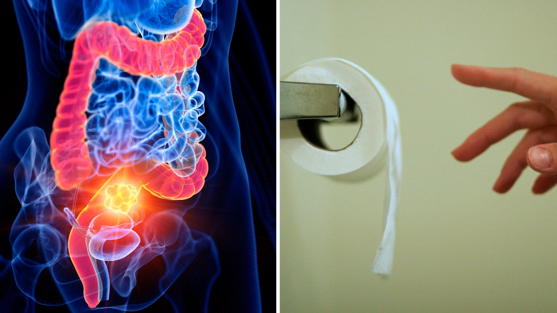 Gen Z warned to look out for two symptoms of ‘highly concerning’ cancer as cases surge among young people