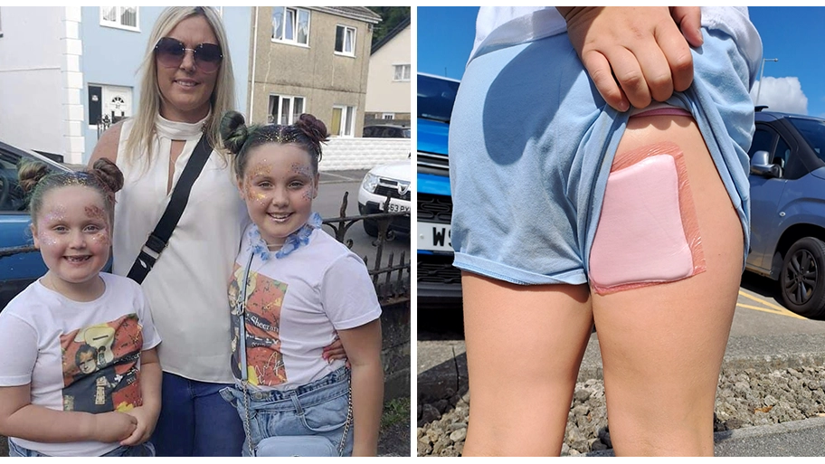 Mum's warning after girl is left with horror burns from 'death slide' at play centre