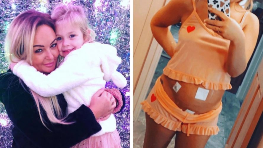 Woman welcomes miracle baby despite endometriosis and early menopause