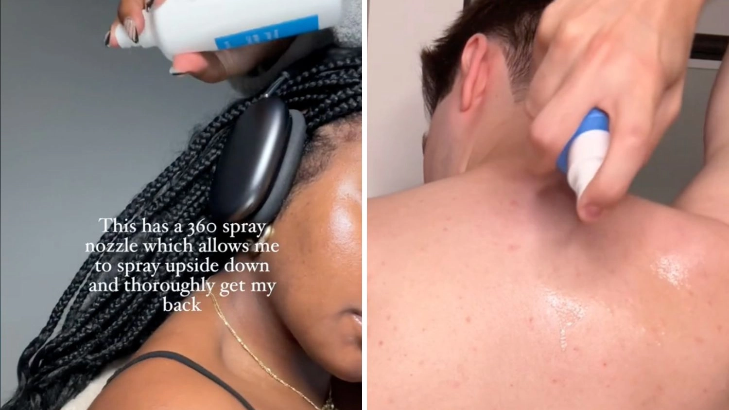 People say 'miracle' spray 'is only product that gets rid of bacne' after 'years of suffering'