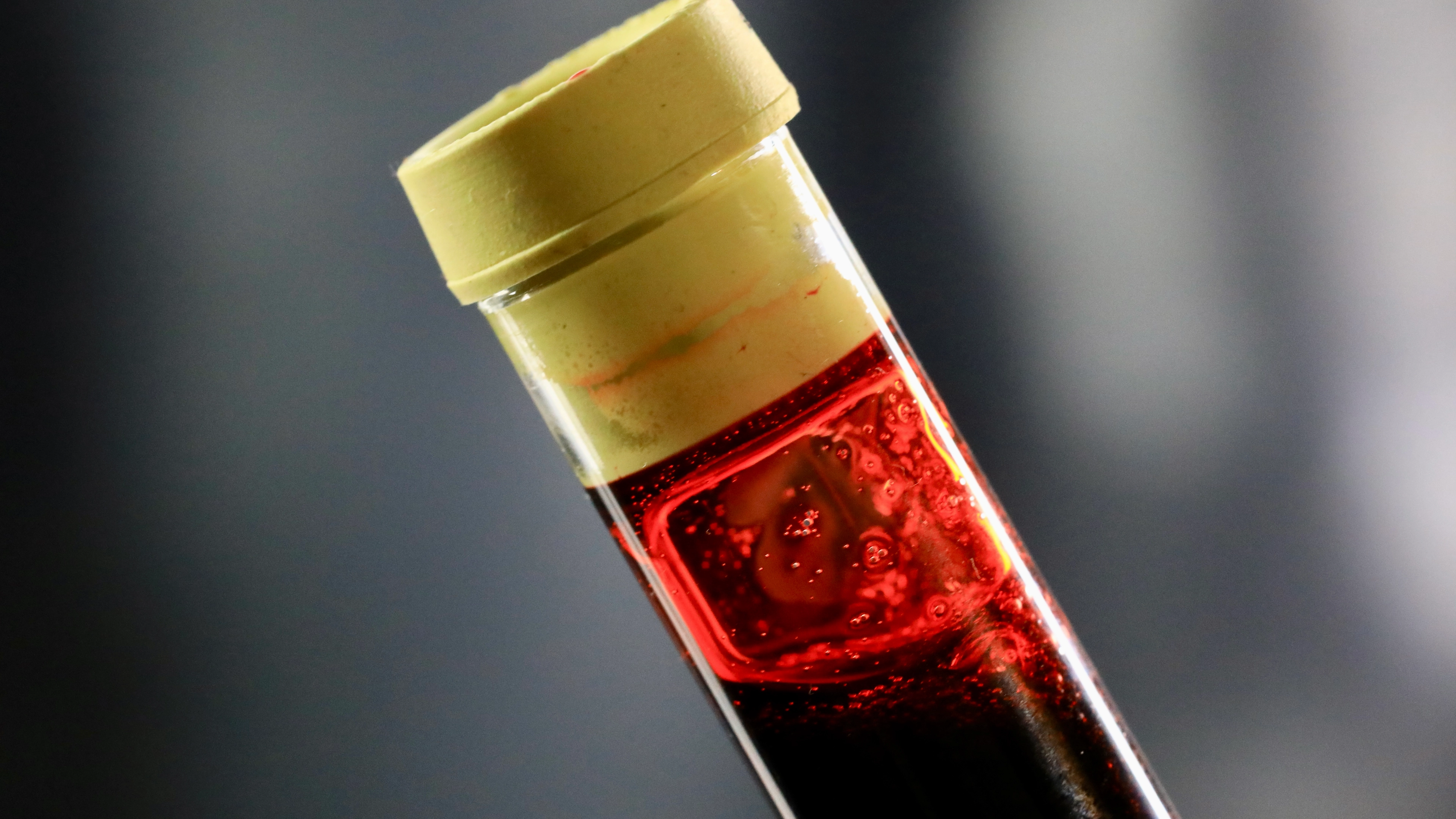 Scientists say people with one blood type are more likely to have a stroke before they’re 60