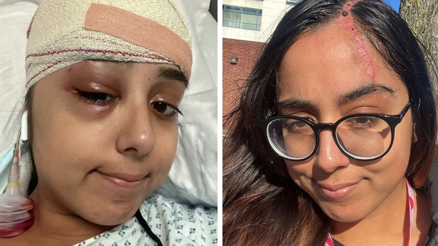 Woman left fearing she'd die when claw clip lodged in her scalp after horror car crash