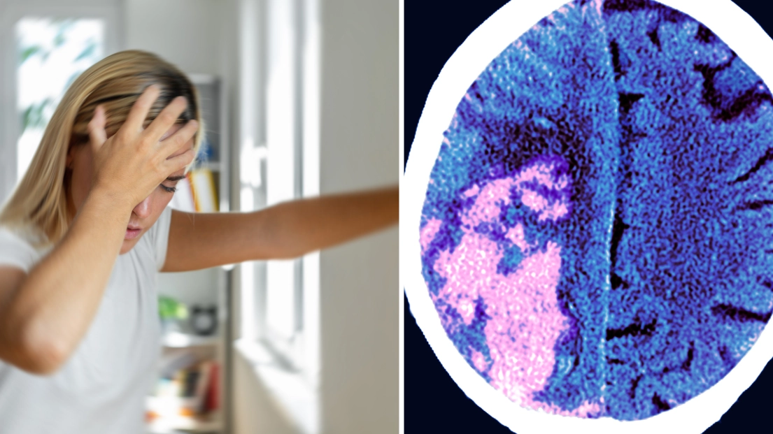 Women warned over ‘silent strokes’ as five signs could mean you’re having one without realising