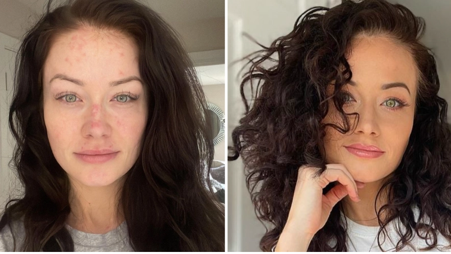 Jess Impiazzi thought she was dying before being diagnosed with incurable condition