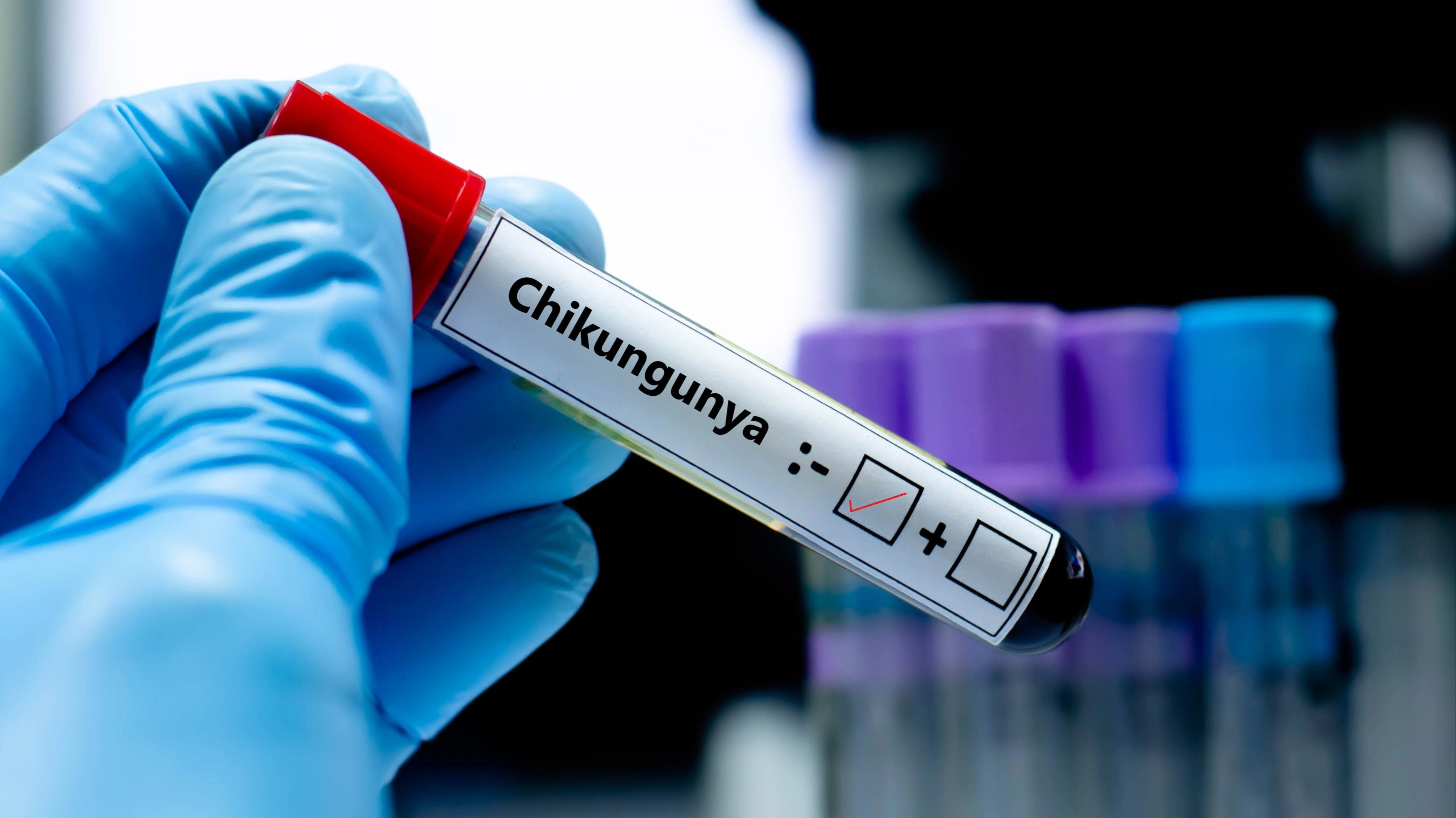 Doctors issue warning over symptoms of 'Chikungunya virus' as US state confirms first case in 6 years