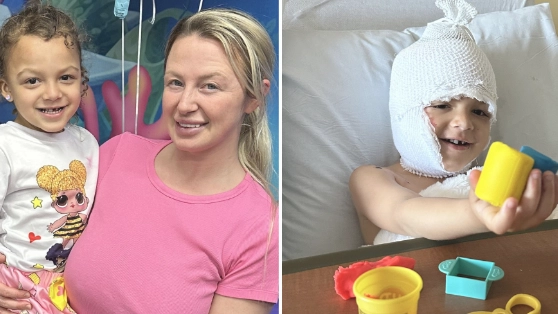 Toddler's face 'melts off' when boiling bowl of ramen spills over her head during game of tag