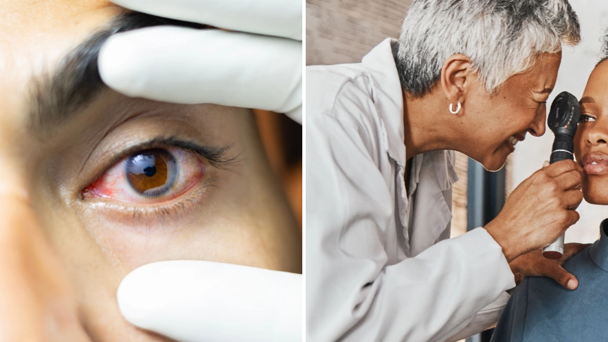 Eye doctor reveals three surprising things they can tell about you simply from looking at your eyes