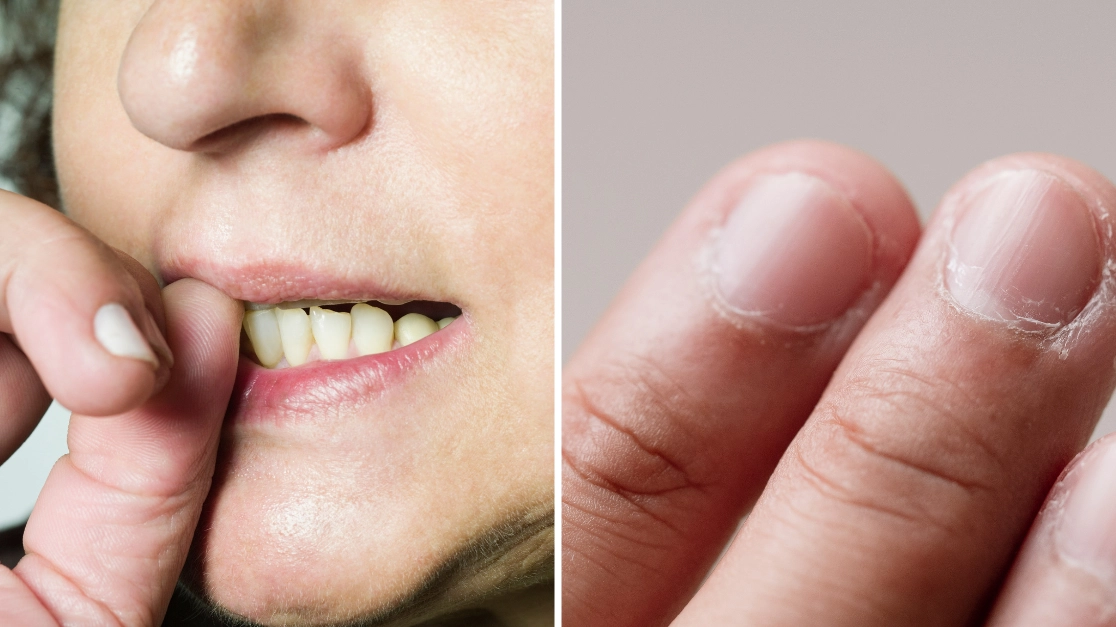 How to tell if your nail biting is actually a pathological problem