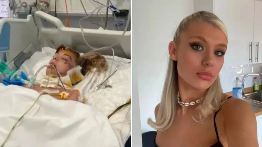 Woman left with broken spine and in a coma after horrifying Ayia Napa buggy crash