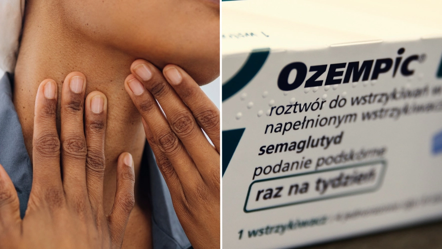Doctor issues warning over 'Ozempic face' side effects as drug surges in popularity