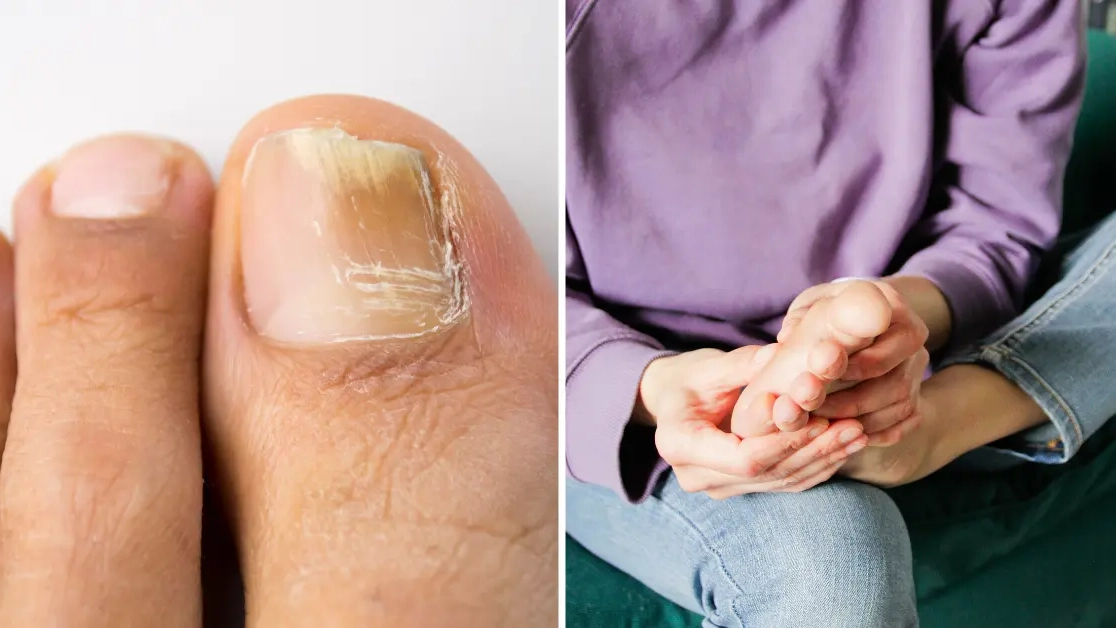 Official NHS advice as pharmacist reveals two warning signs of silent killer that you might see on your feet
