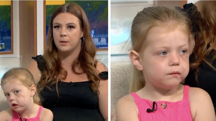 Mum fought off crazed XL bully dog to stop it from mauling four-year-old daughter