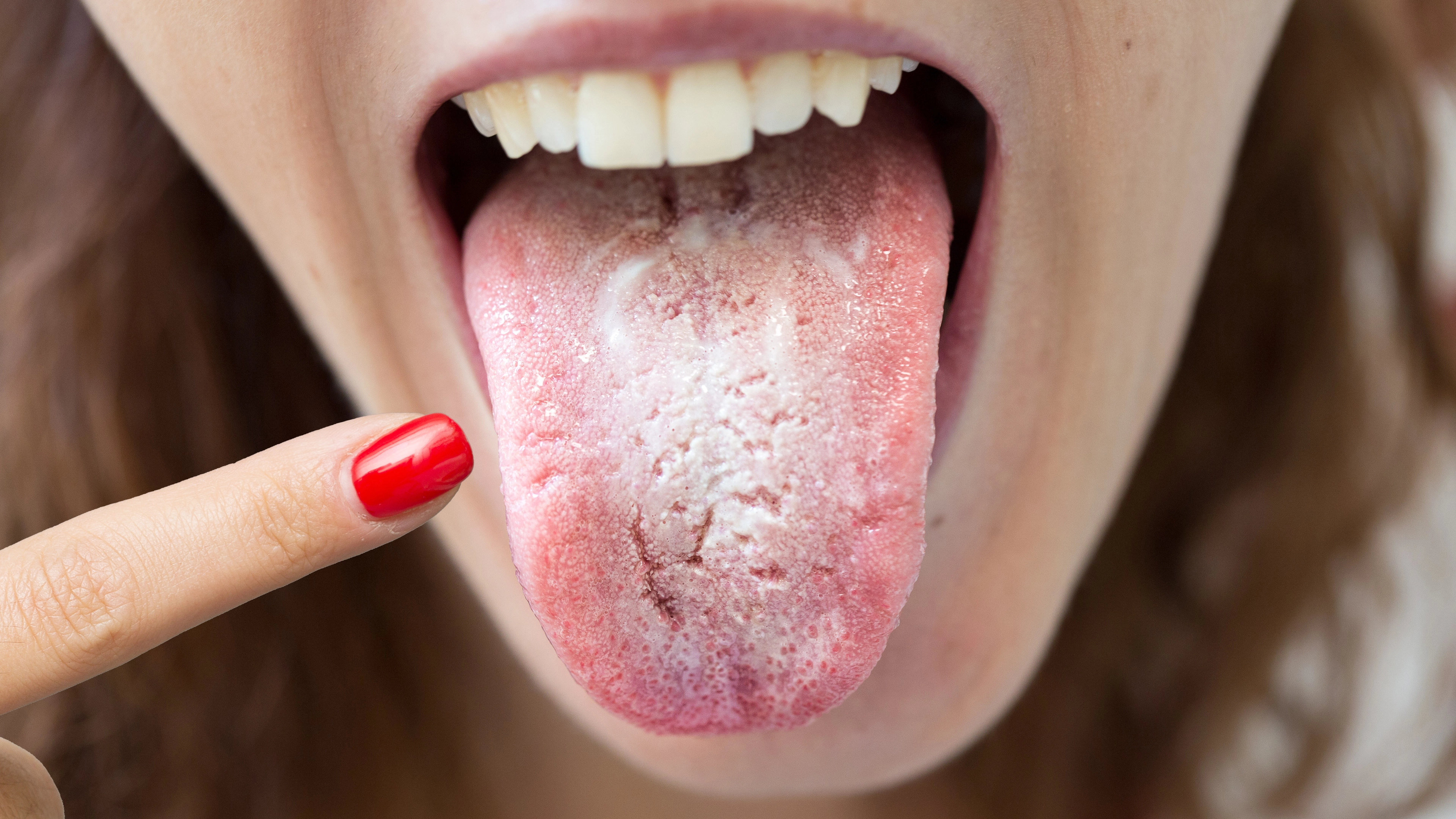 Seriously gross reasons why you might wake up with bad taste lingering in your mouth