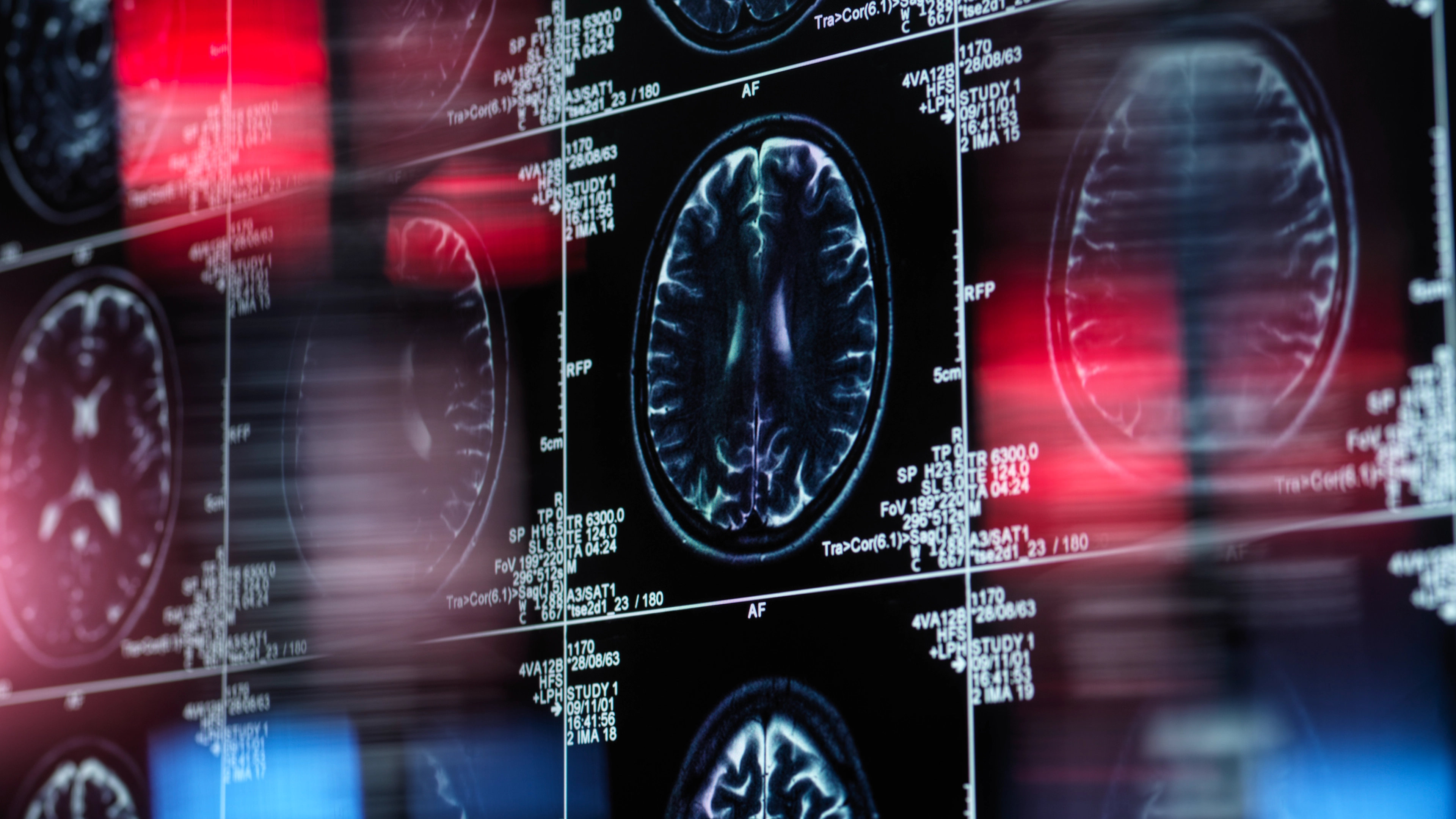 Experts warn there are phrases to look out for that could mean someone has dementia