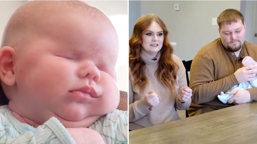 Baby girl born without eyes due to ‘incredibly rare’ condition say doctors
