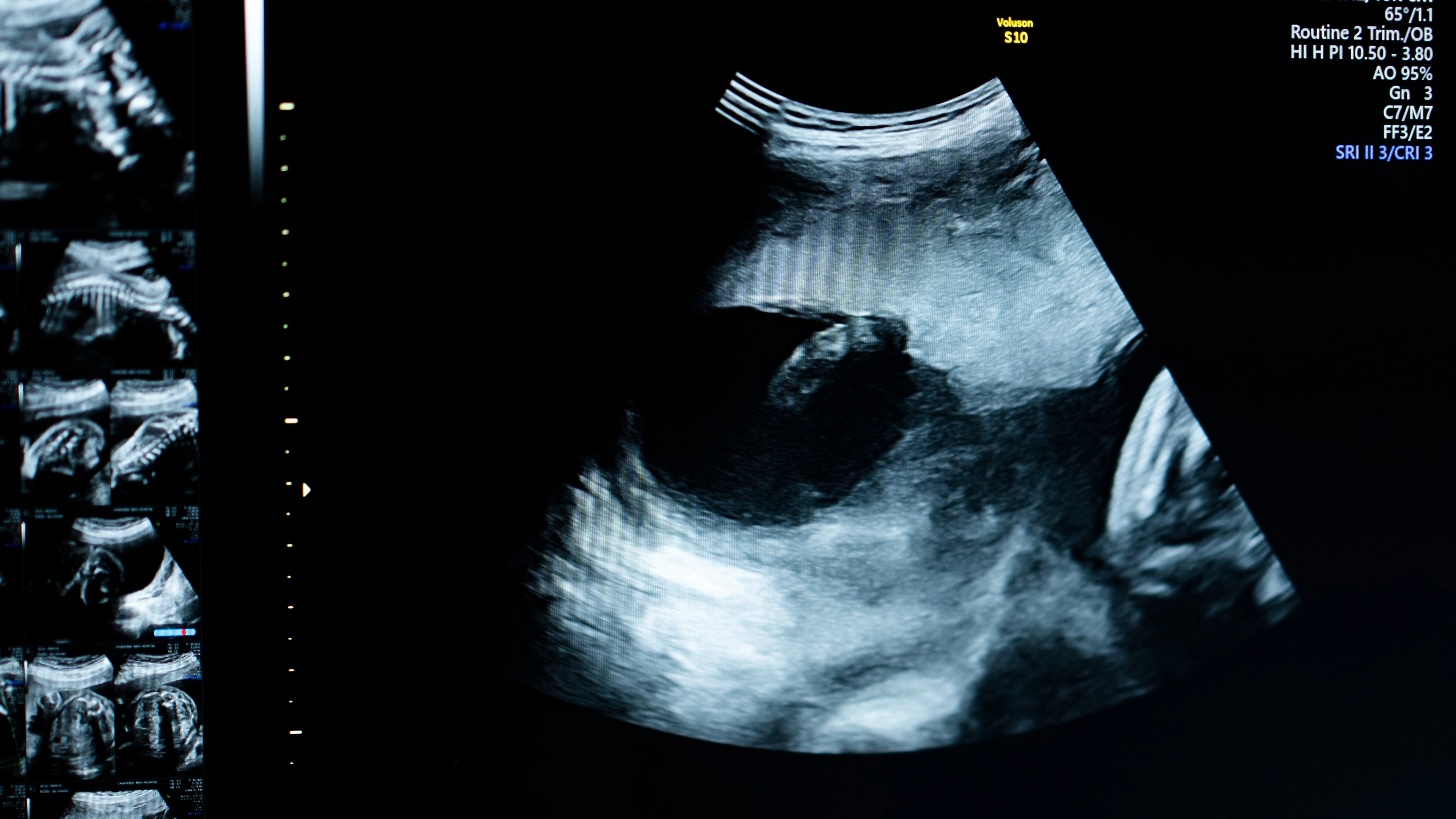 Woman sues abortion pill company and claims ex tricked her into terminating pregnancy with drink