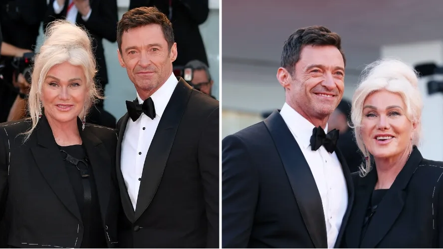 Hugh Jackman and wife Deborra-Lee Jackman announce they’re separating