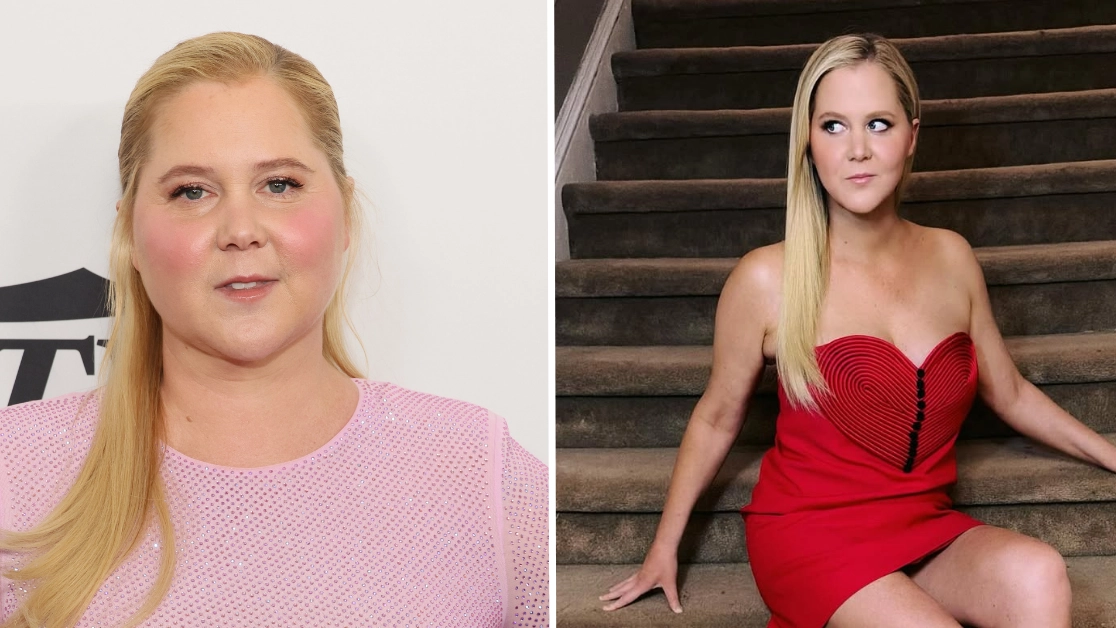 Amy Schumer reveals reason for 50lb weight loss after ‘moon face’ led to diagnosis of rare disease