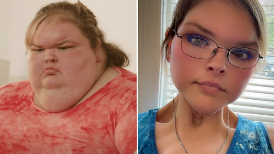 1000-lb Sisters’ Tammy Slaton shares shocking new photos months after skin removal surgery and fans are saying the same thing