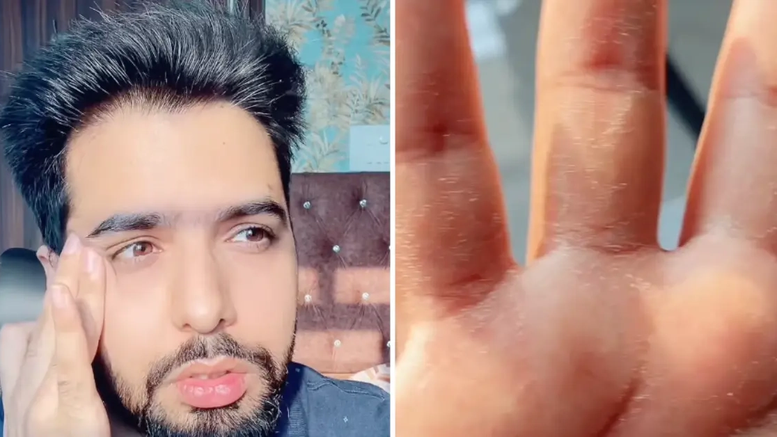 Abuse expert reveals eight symptoms in your body that could be a result of narcissistic abuse
