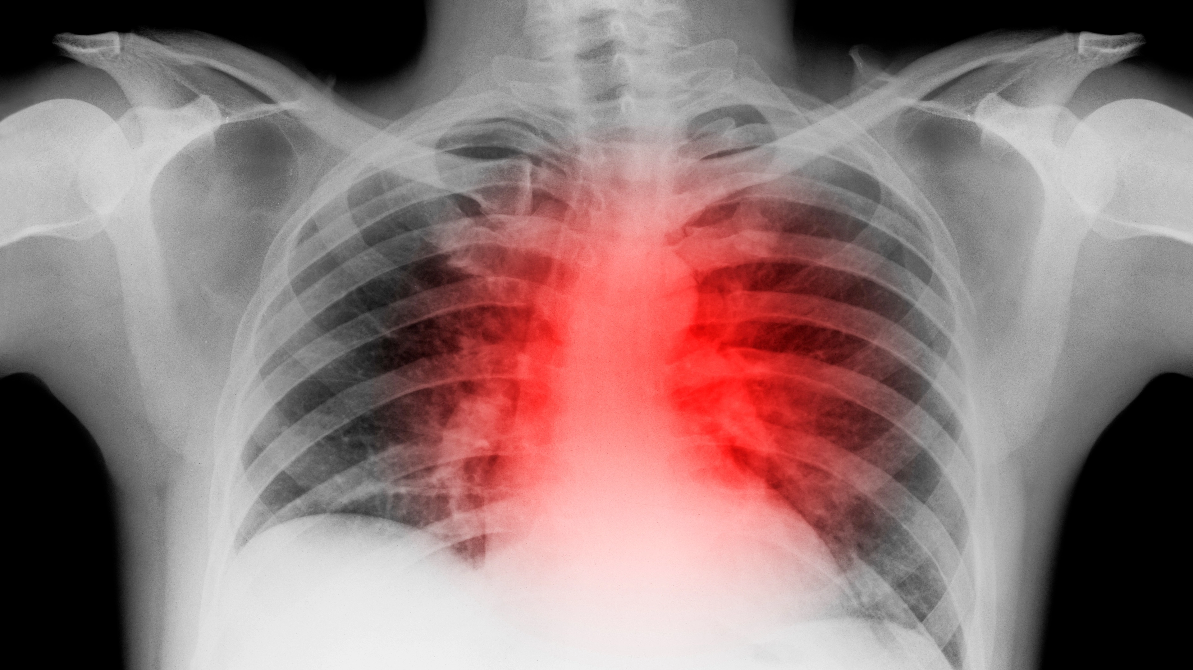 Warning signs of ‘silent killer’ disease that poses greater risk to women than breast cancer