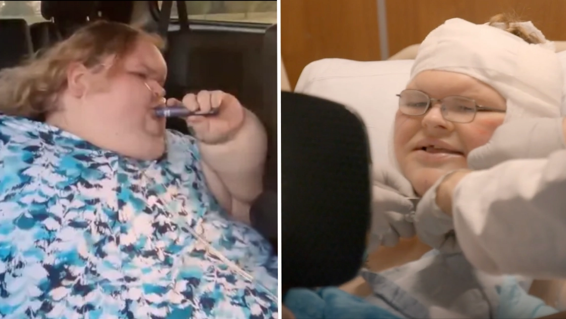 1000-lb Sisters’ Tammy Slaton issues statement after facing ‘vaping’ accusations amid major skin removal transformation