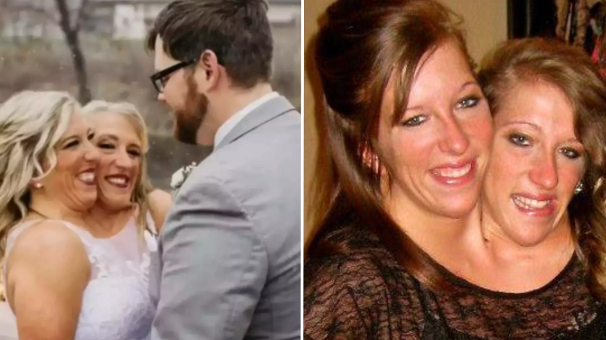 Conjoined twins Abby and Brittany Hensel hit back at cruel trolls after one of the sisters gets married