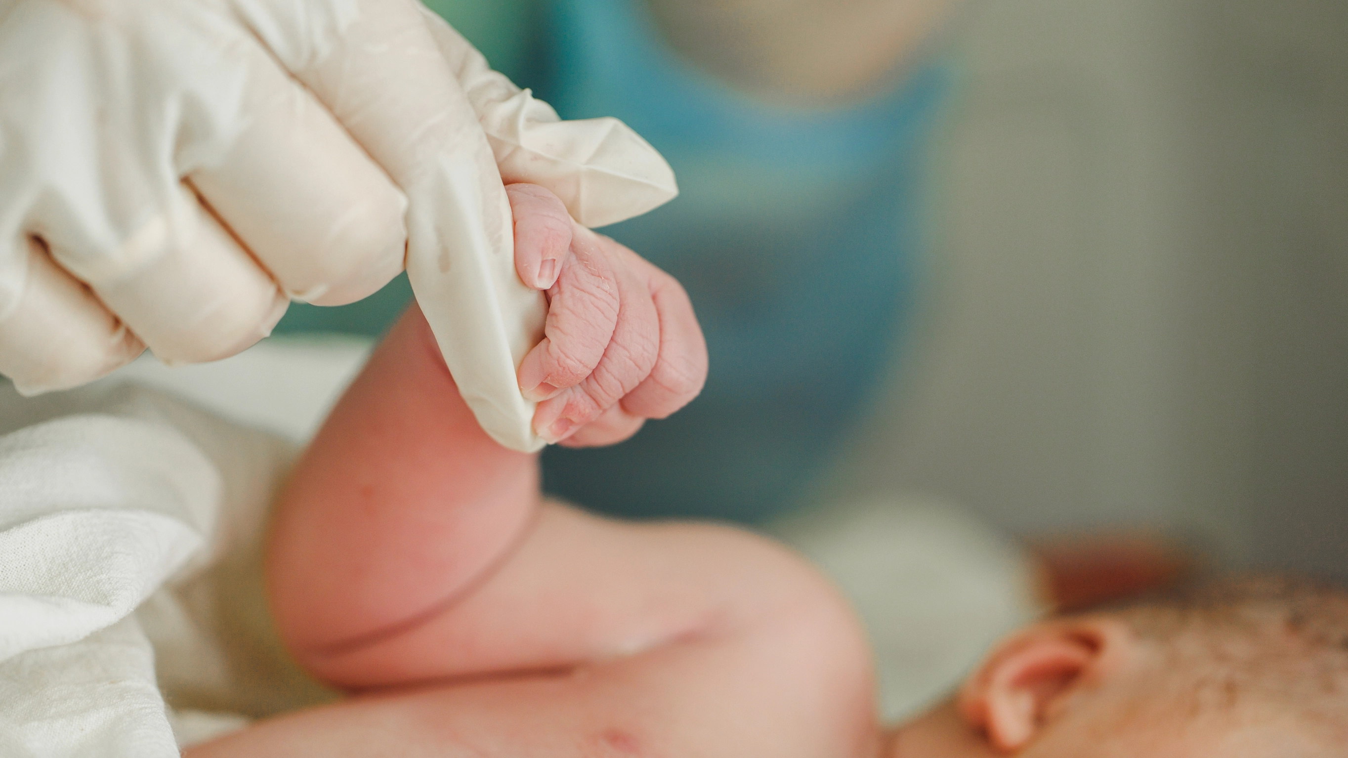 Doctors notice alarming trait in newborns hours after birth