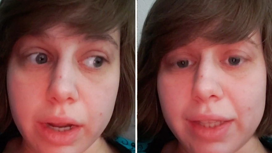 Woman with no desire to be a mum has hysterectomy at 28