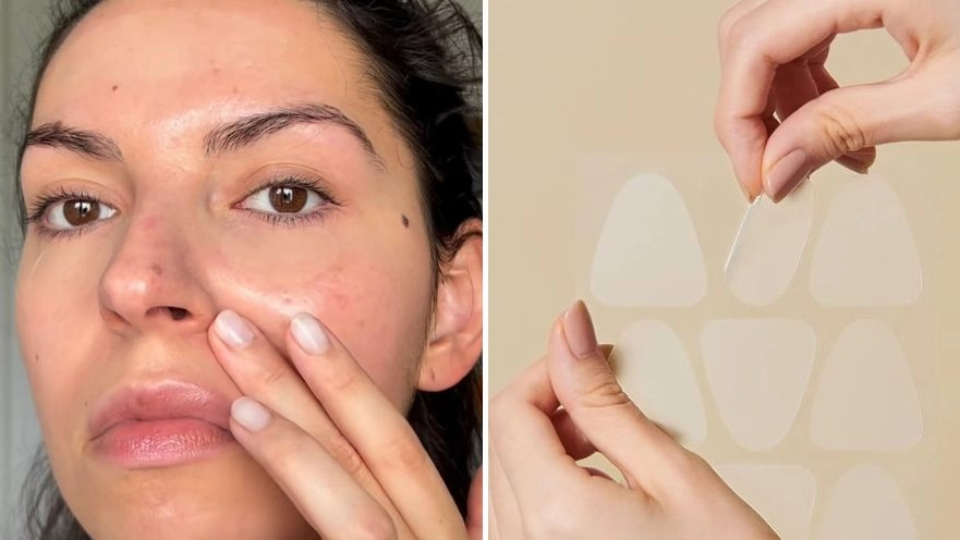 People are ditching botox for 'game-changing' patches that 'reduce wrinkles overnight'